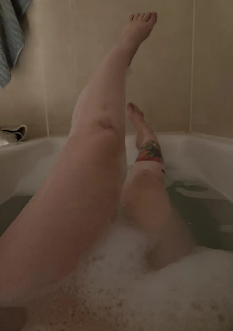 I’ve got to say that it hurts posted by SiNdarElle