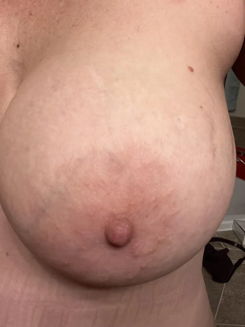 Just one posted by Most-Detective-9243