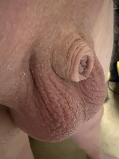 Just skin by Miserable_Usual_4714