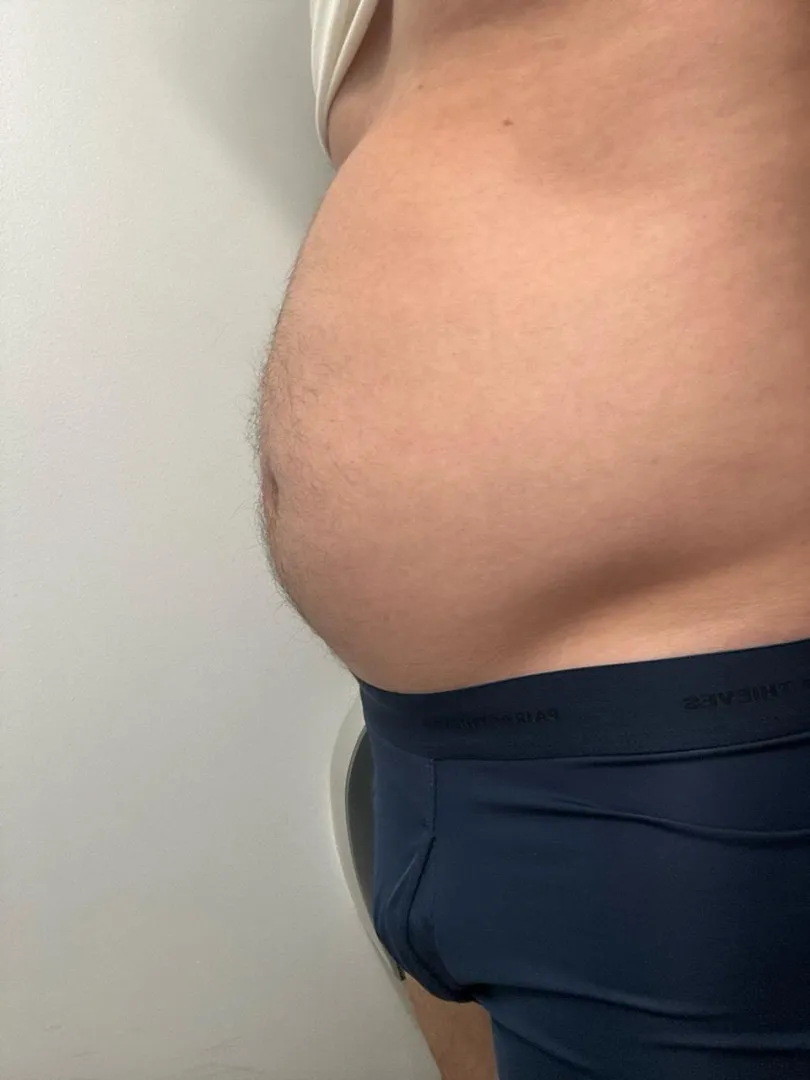 Just started gaining and most of it goes to my belly. Do women like beer bellied guys? posted by mattyscores0615