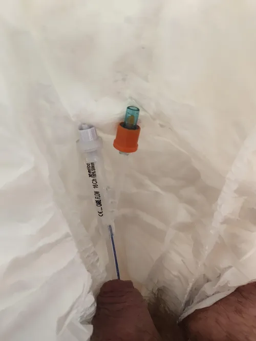 Lazy Sunday with catheter and daiper by Plenty_Concept_1702