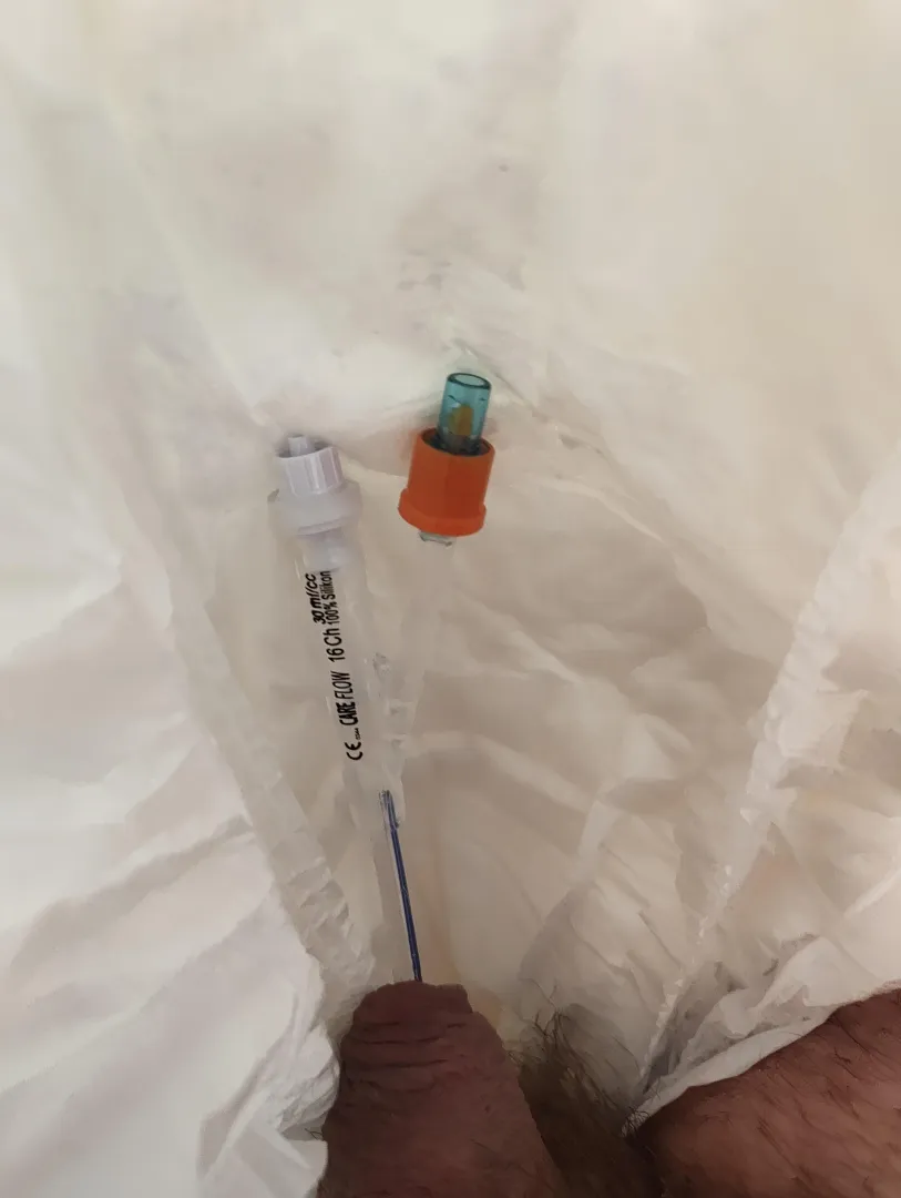 Lazy Sunday with catheter and daiper posted by Plenty_Concept_1702