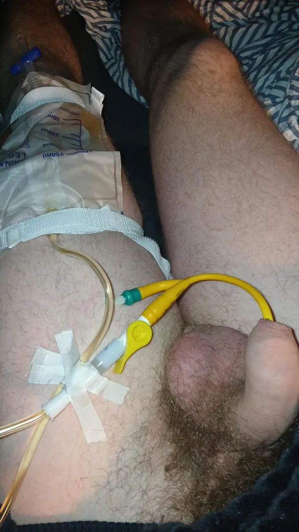 leg bag is nice here so you don't have to carry so much weight i think I'm hooked posted by baak20001