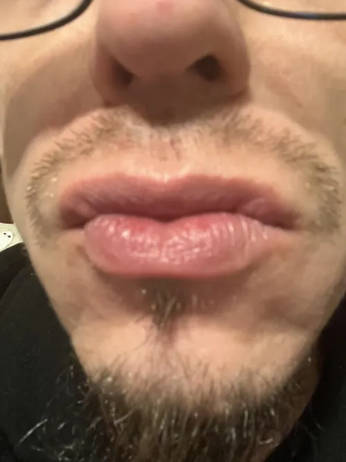 Lips by Vegetable_Rub_2829