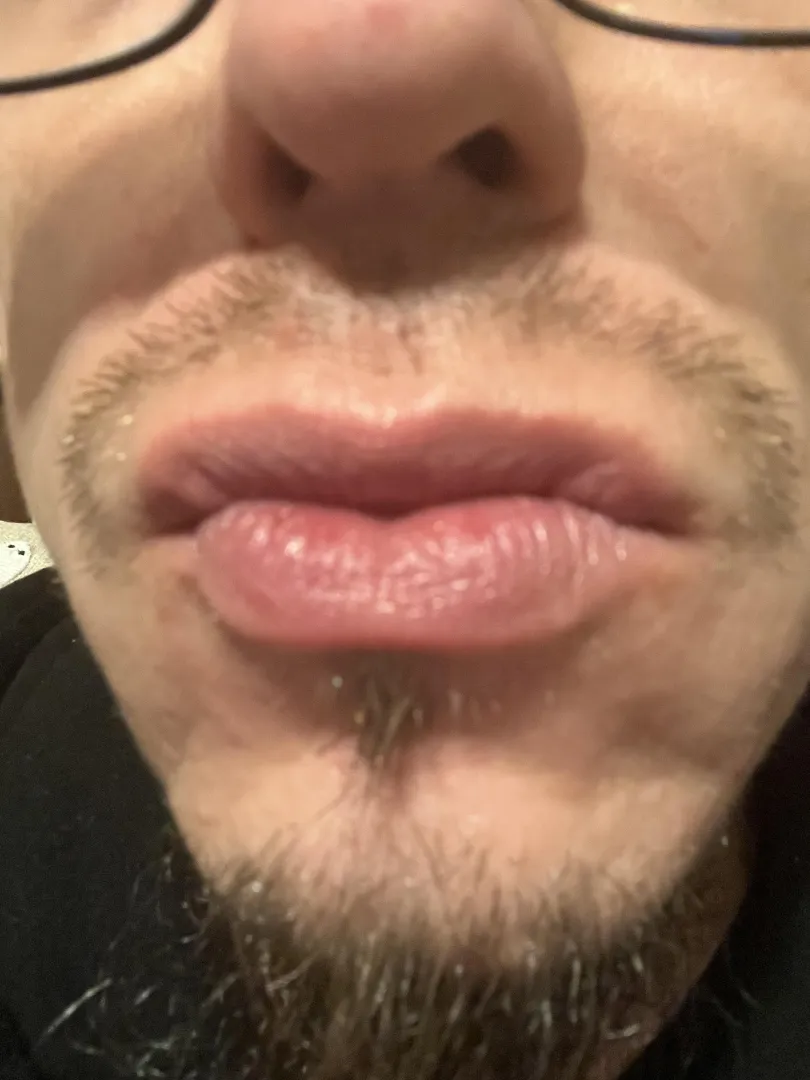 Lips posted by Vegetable_Rub_2829