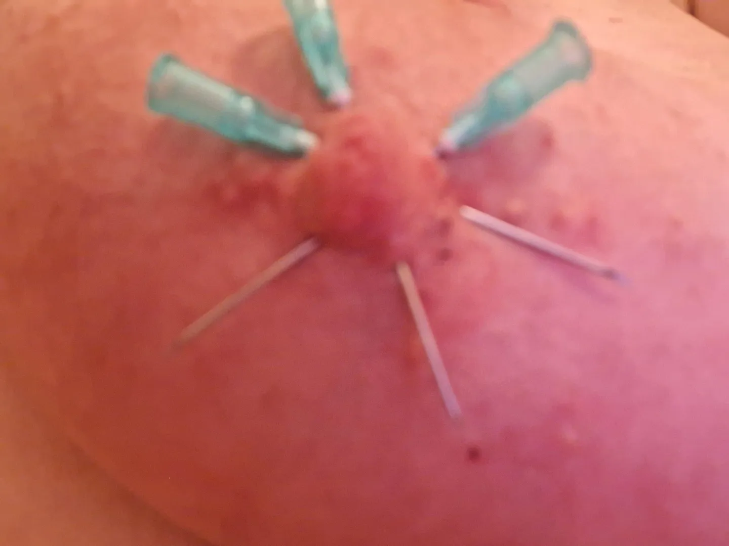 Little needle flower posted by VanillaScentedRX