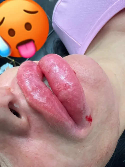 Live heute Abend 20 uhr mit neuen dicken Lippen by Doll_from_the_boss