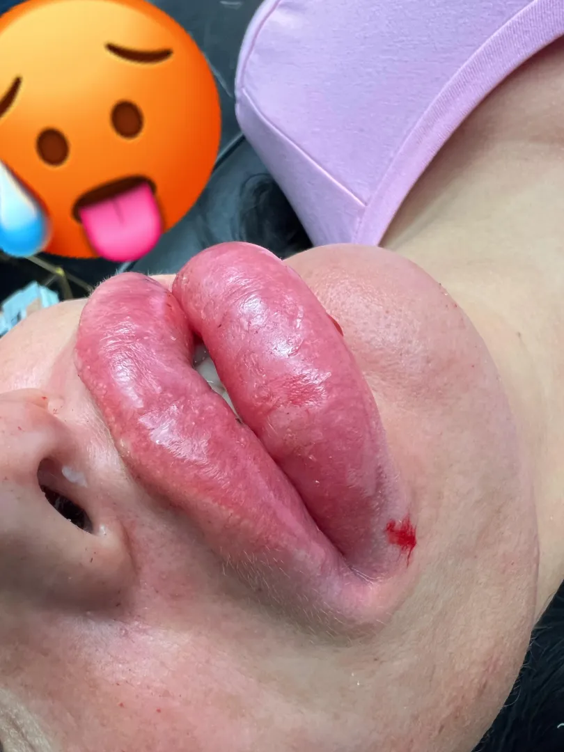 Live heute Abend 20 uhr mit neuen dicken Lippen posted by Doll_from_the_boss