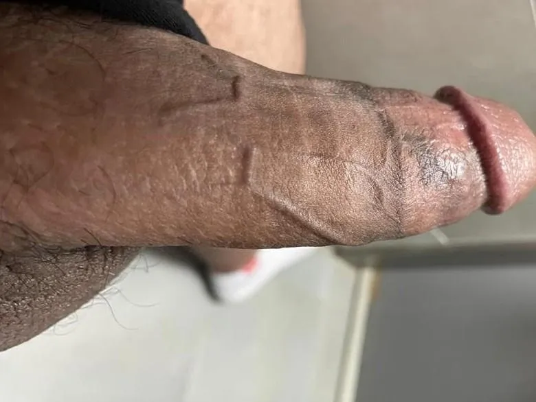 Long time no see I miss reddit am 19♠️ posted by loveyo19