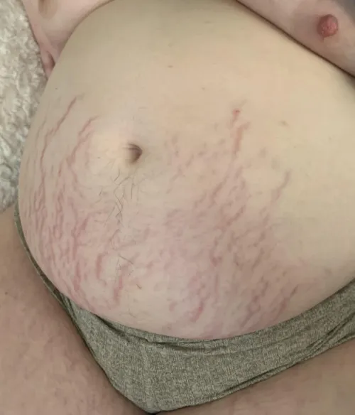 Look at how ripped up I am from being a big fat pig by bra1nr0tt3np1ggy