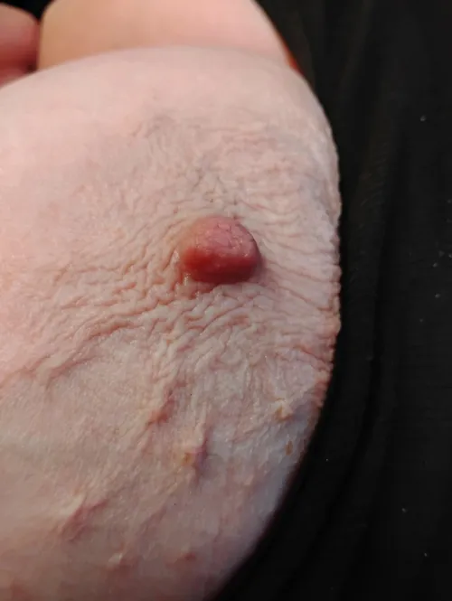 Love her wrinkles by Every-Diver-8570