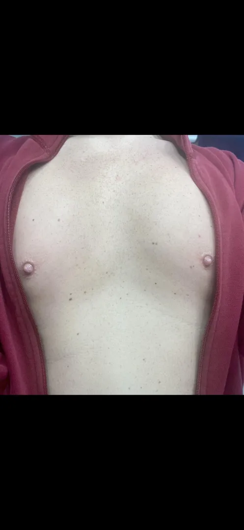Love my nipples pumped posted by btmguy73270