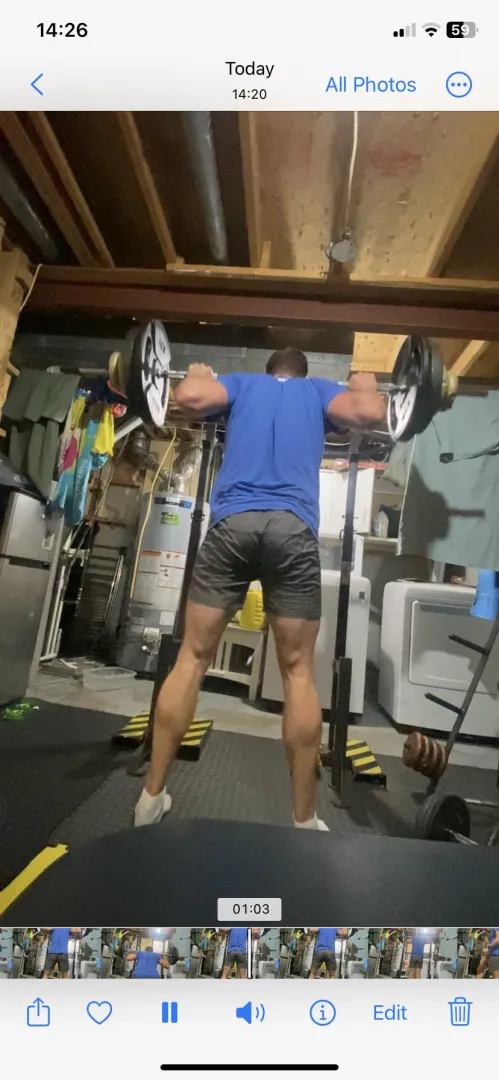 Lumps behind knees, need help identifying them. Cysts or muscle? Please help posted by Over-Instruction-641