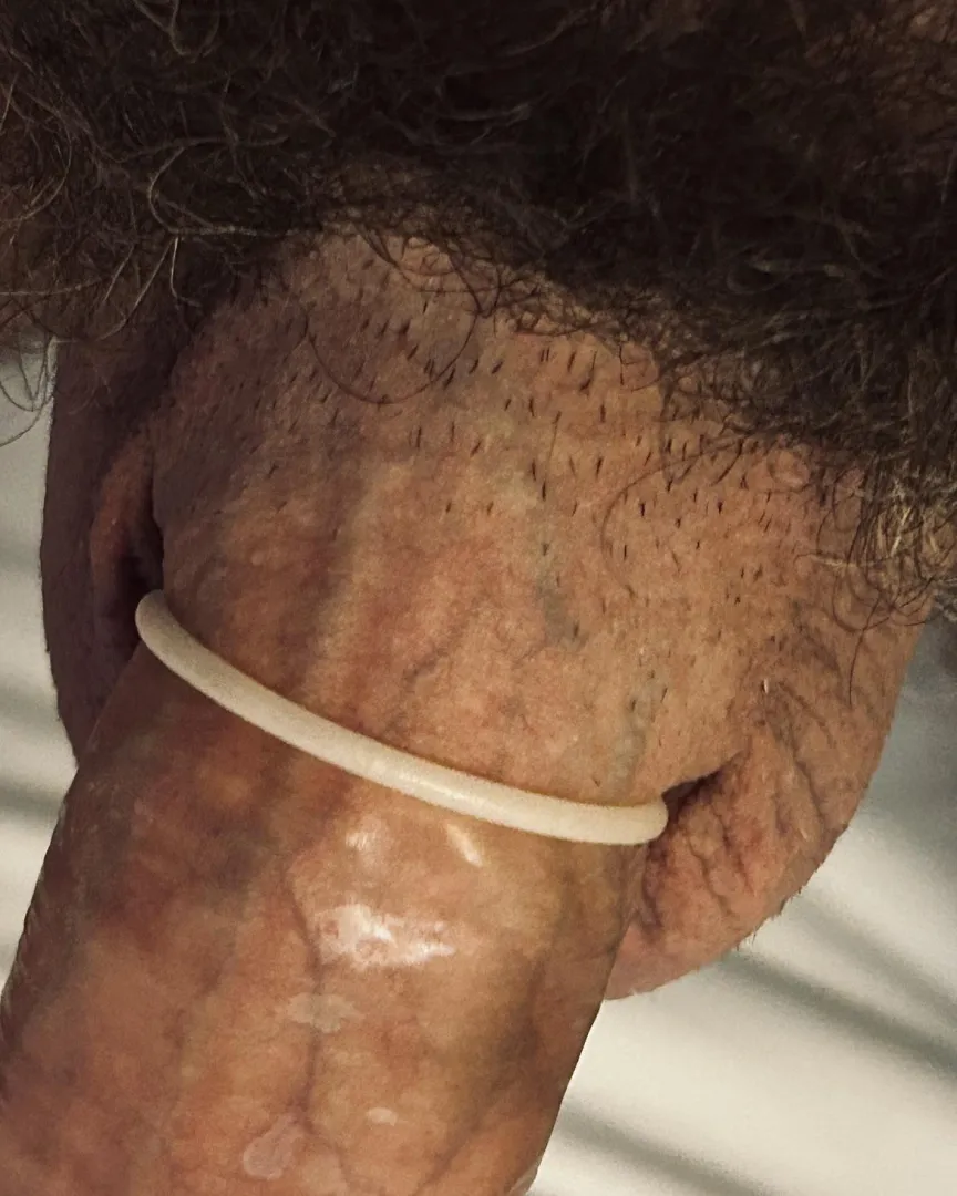 [M] I wear king size or XL rubbers and they're *still* too tight on my dickshaft... posted by Grant6000