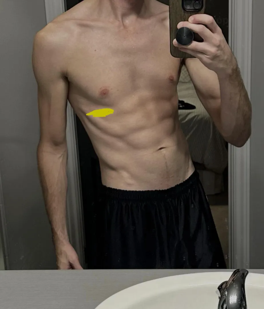 [M]ake YVR Sexy Again posted by Far-Impact8035