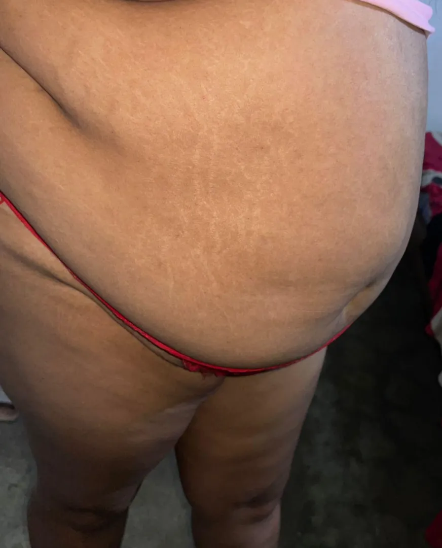 Mis rallas están creciendo oww  posted by ShoeMental4180