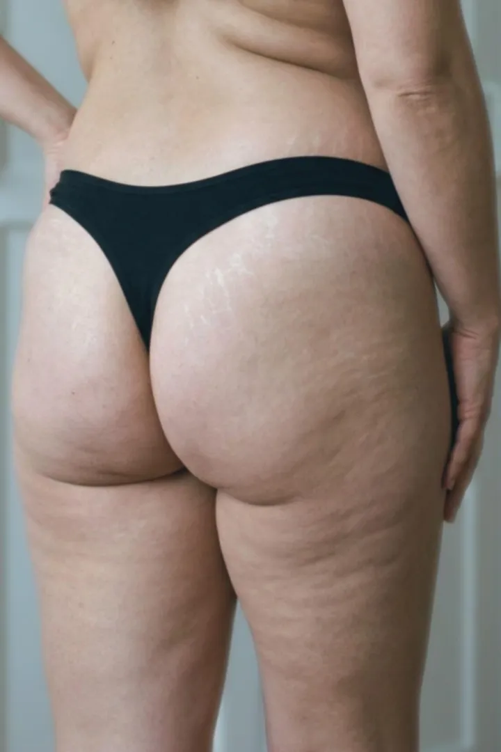 Mommy's back side [40] posted by annasecretly