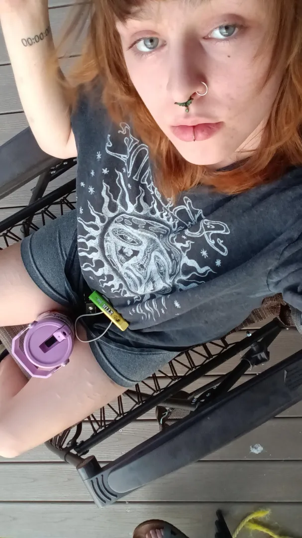 Morning scars posted by saraonly420