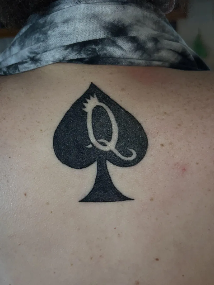 Mostly healed… posted by Lucky_Owl5346