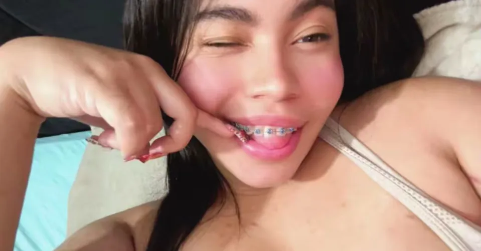 My bedazzled teeth by Used-Professional548