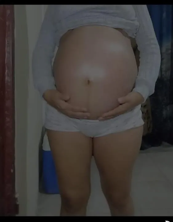 My belly during my first pregnancy was enormous posted by akmv1312