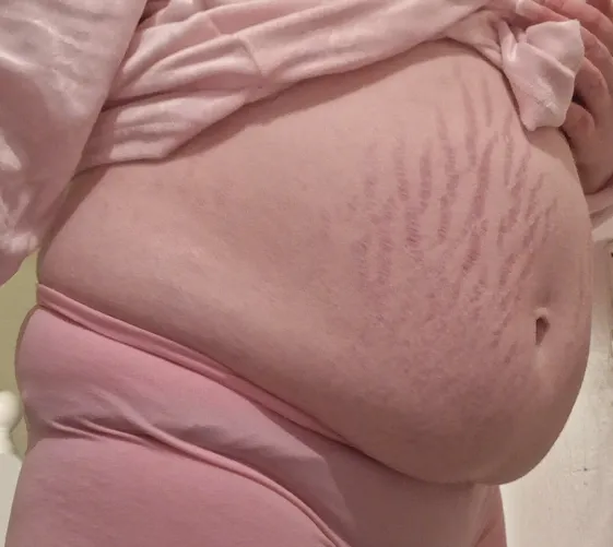 My bellys really showing ;3 by One_Choice_8681