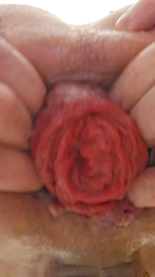 My biggest ever. posted by Canadian_FWB