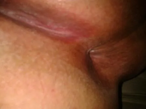 My butthole posted by MiserableAd4733