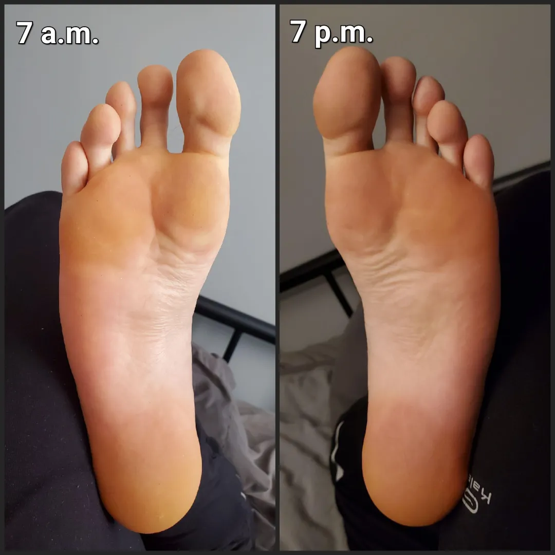 My feet, in the early morning and at the end of the day. See a difference? posted by TimH992