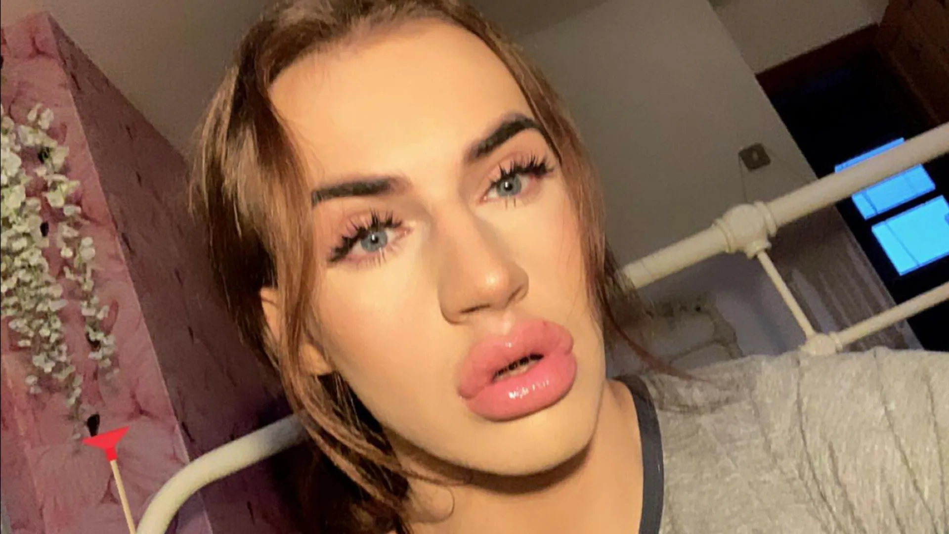 My freshly filled lips posted by LookAtPrincess