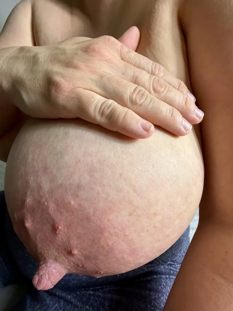 My little finger vs the nipple posted by AngelNextDoor