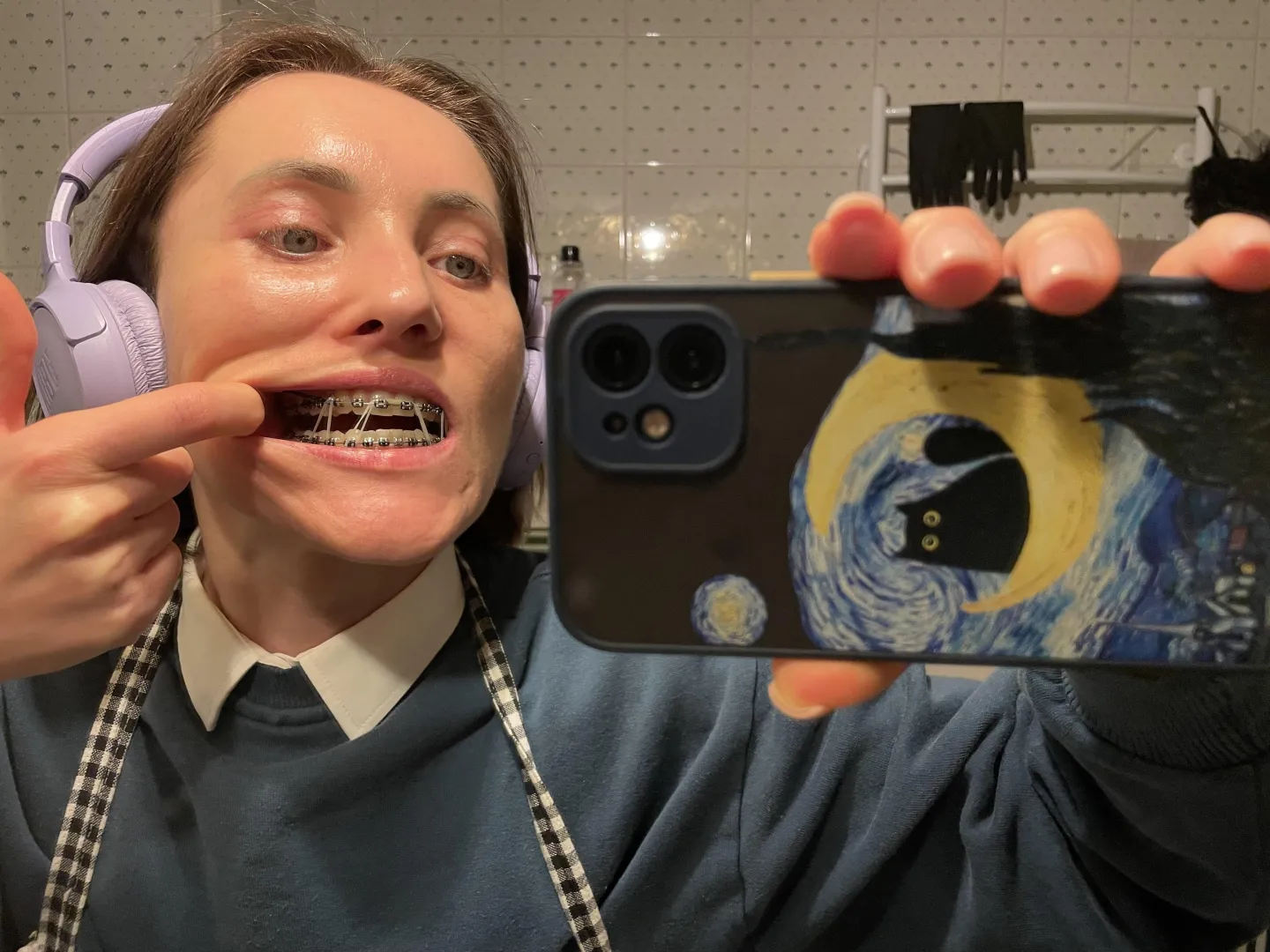 My new elastics posted by Cherry-Cinnabon