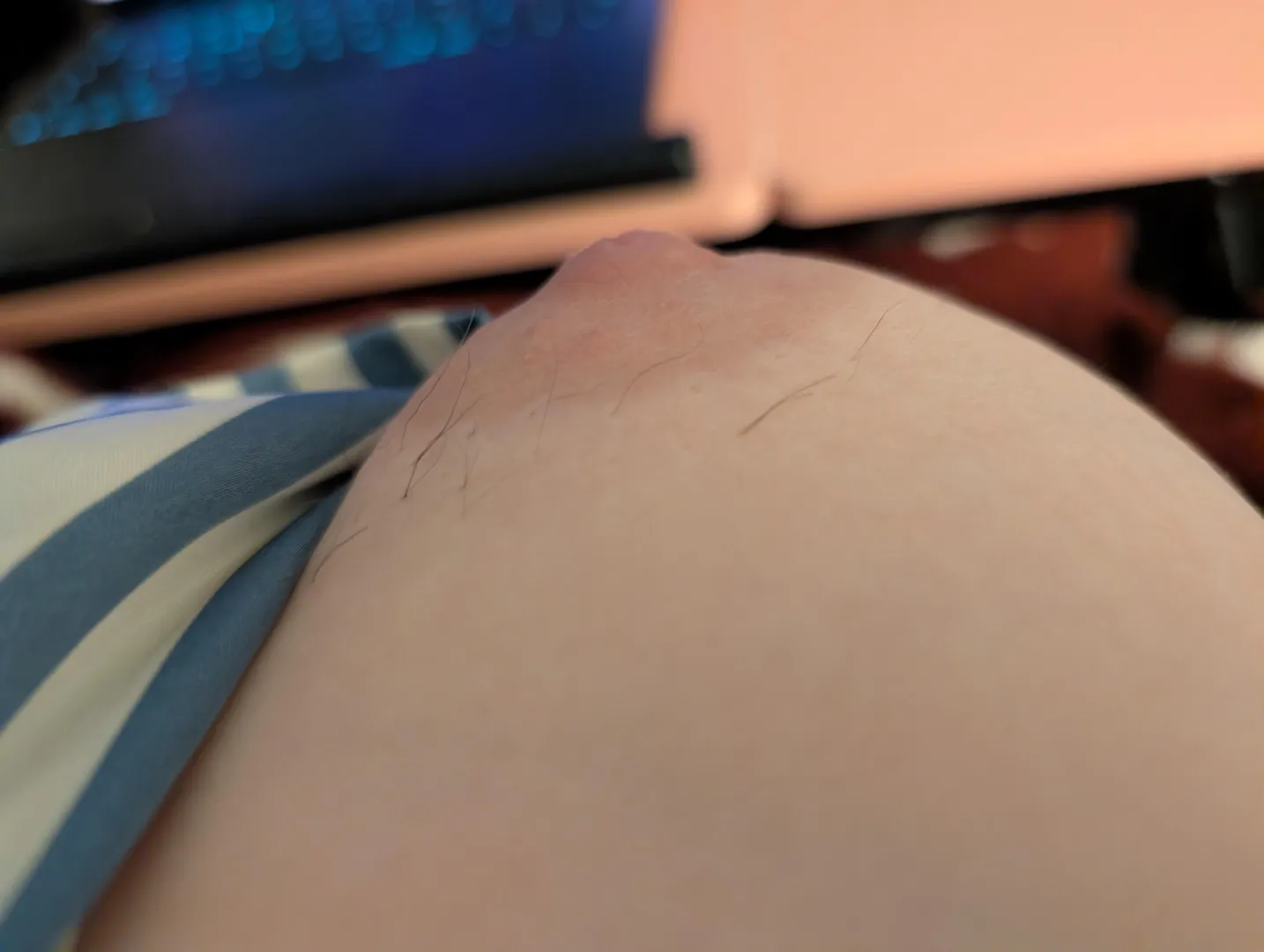 My nipple hairs grow so dark posted by EveYourApple