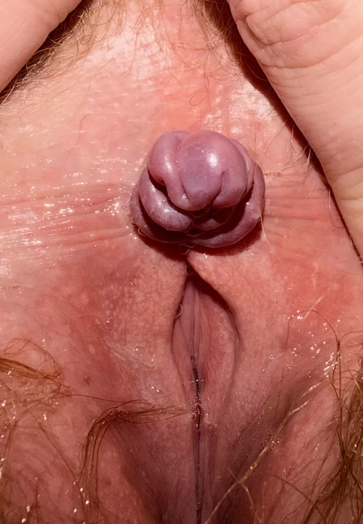 My poor tied clitty  posted by Bbygoonmama