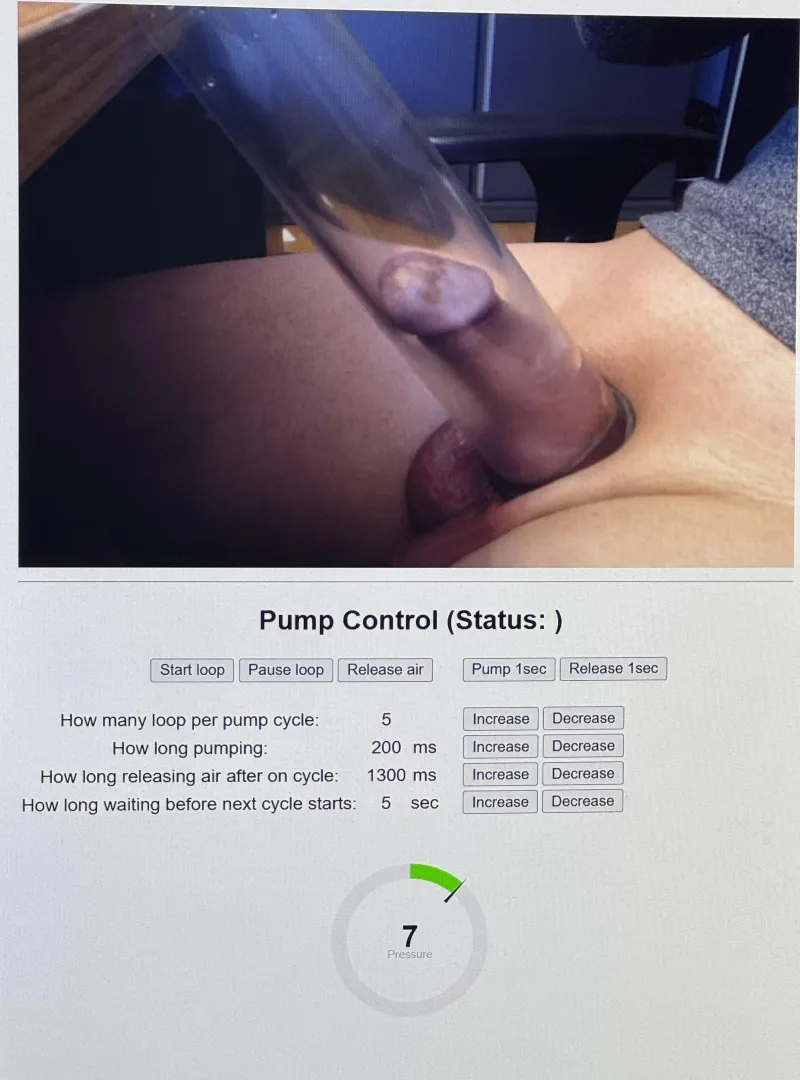 My remote pump is online. Who wants to steer? posted by No-Tale2259