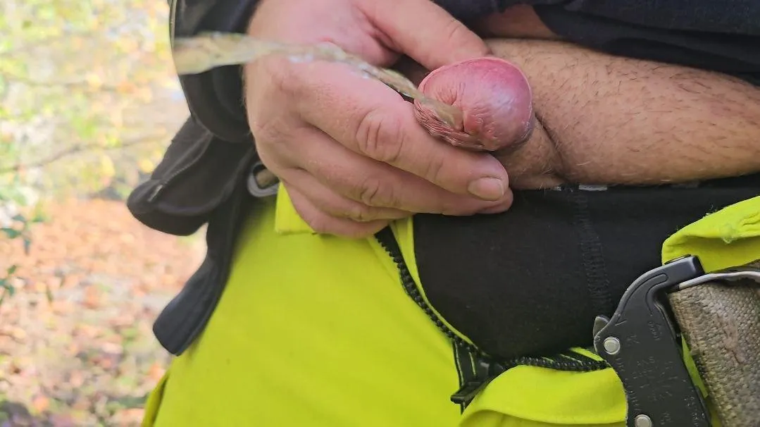 My small hypospadia dick posted by hypoboy26