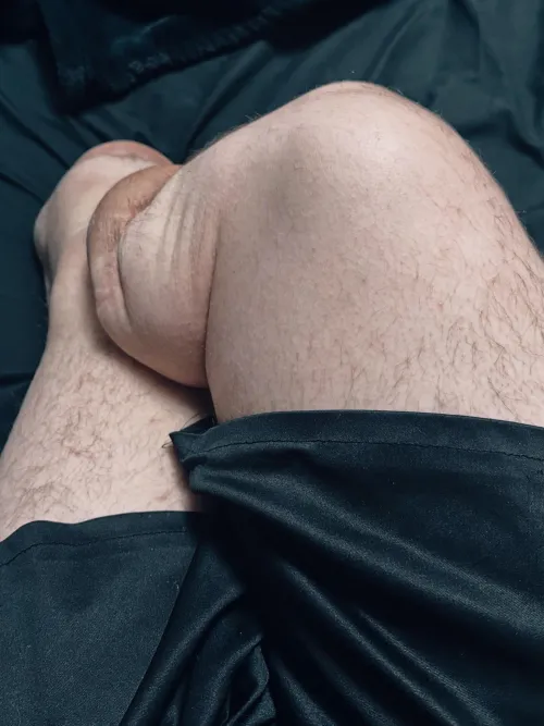 My stumps jiggle so much  by BigAmpLittleDevo