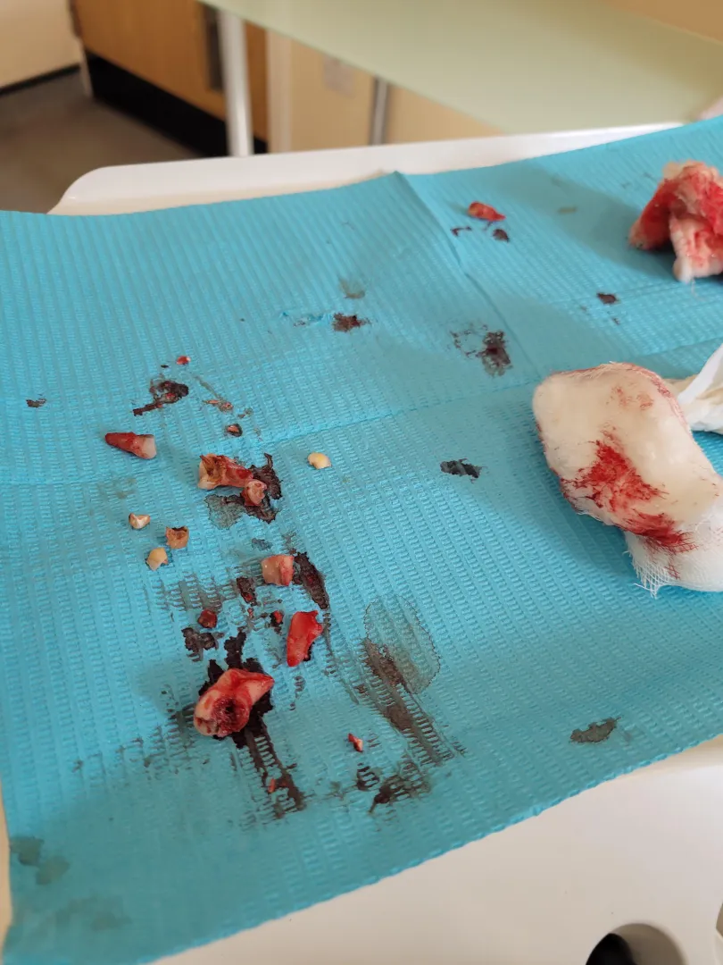 my teeth posted by aclaasr