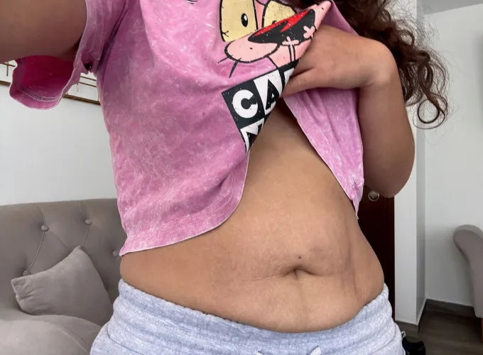 My tiger stripes are super hot on my tummy by NaturalScarlett