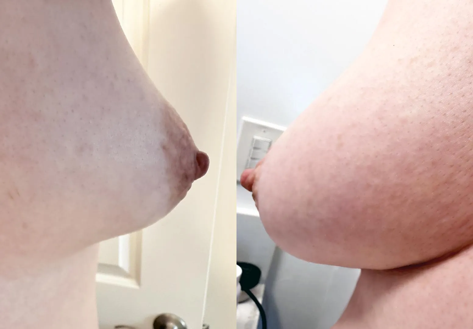 My tubies, side views posted by Amoeba4759