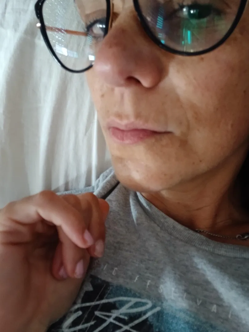 Nariz armenia posted by LovelySkinnyFit