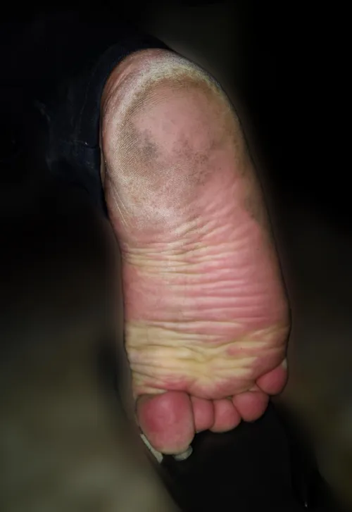 Need someone to clean and moisture my sole ♥️ by Elegant-Morning-8580