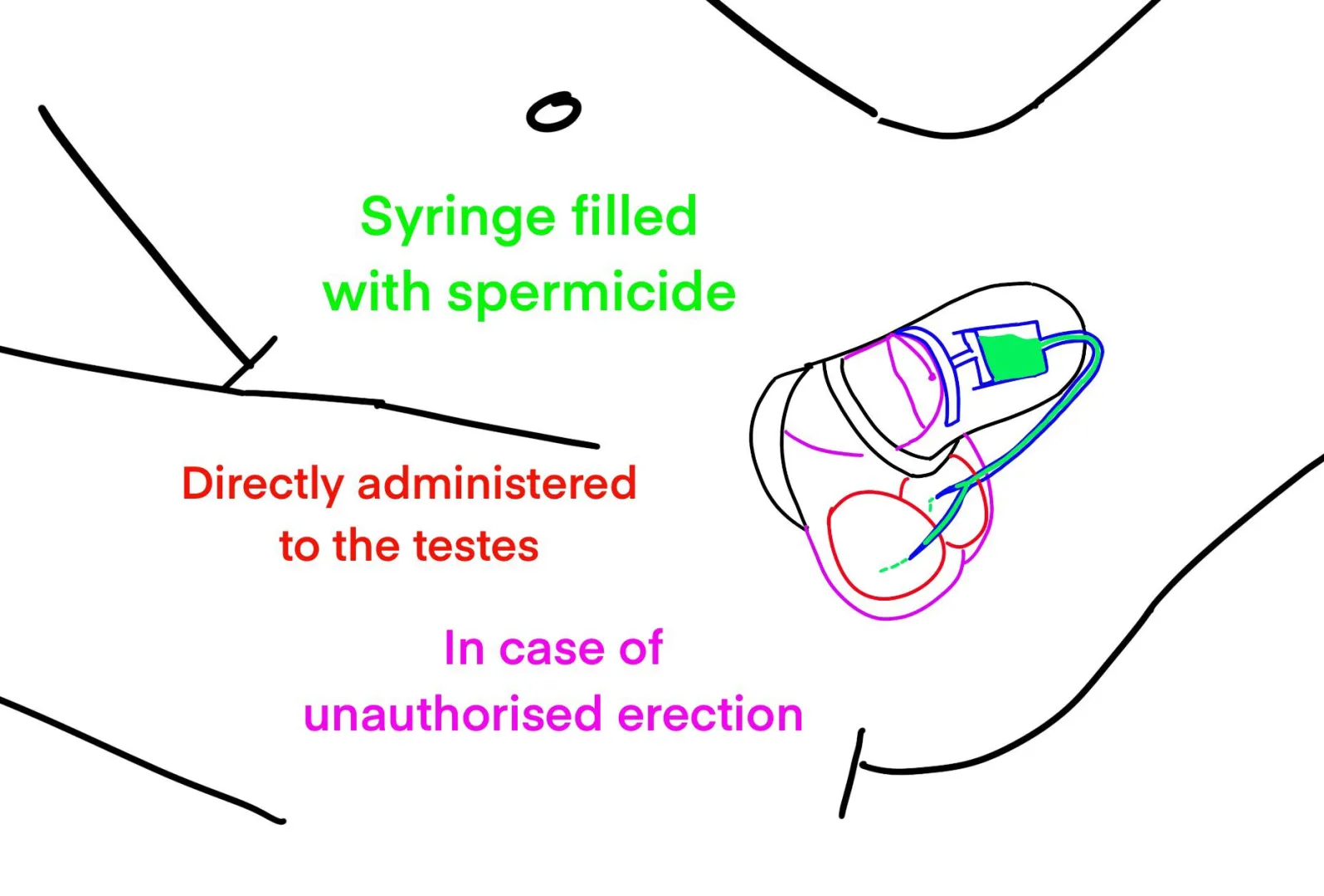 New chastity prototype. Would you sign up for the trial? posted by StrangerCompetitive