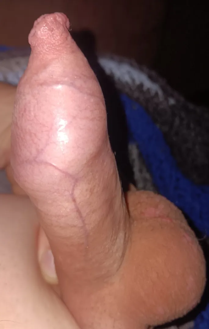 Night time close-up! posted by Upstairs_Source_1337