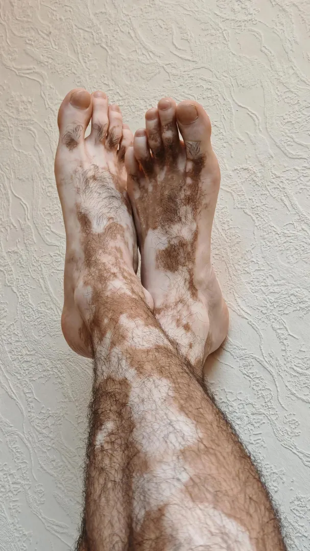 Not a tattoo. Just rare geometry  posted by binshininatin