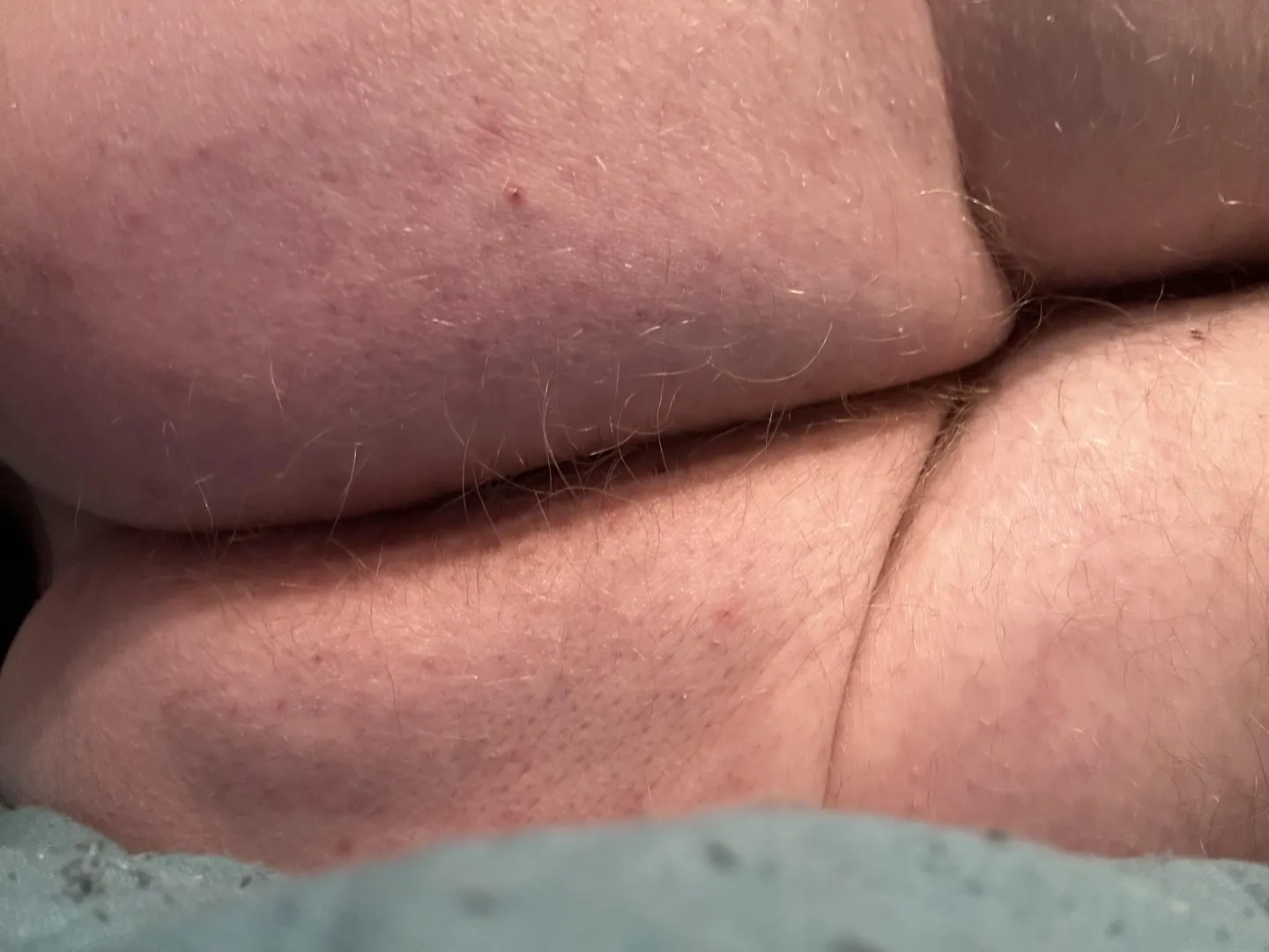 Not my best feature posted by Stunning-View1476