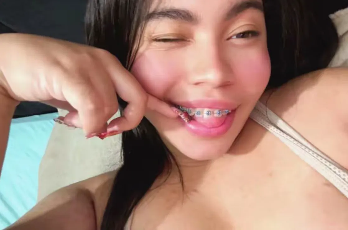 Now I always have something to fidget with posted by Used-Professional548