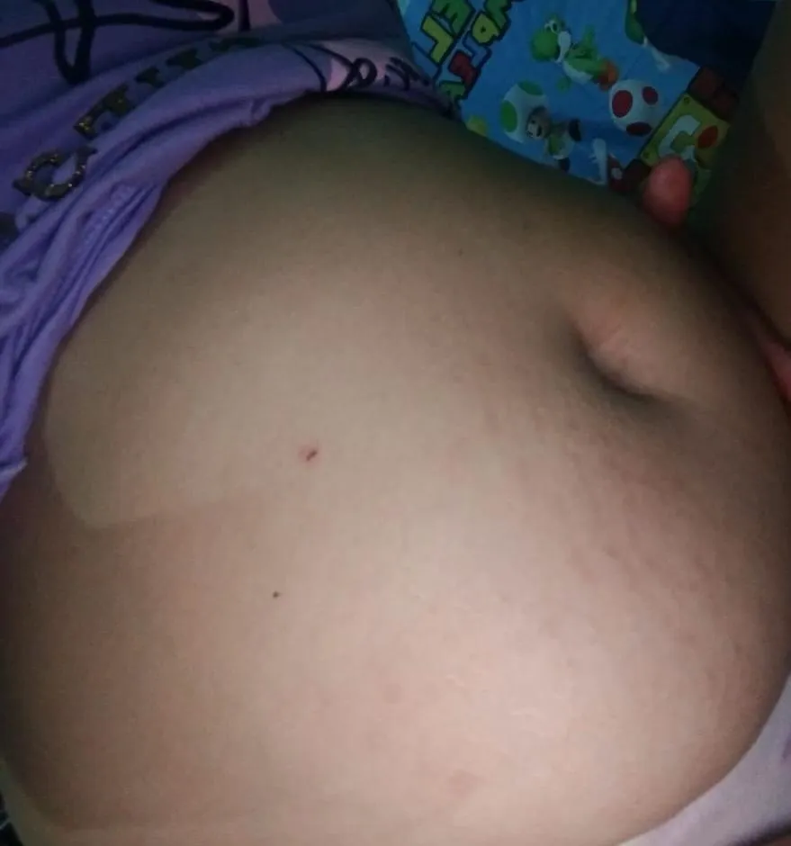 Oil with semen would be a good cream to rub on my belly posted by akmv1312