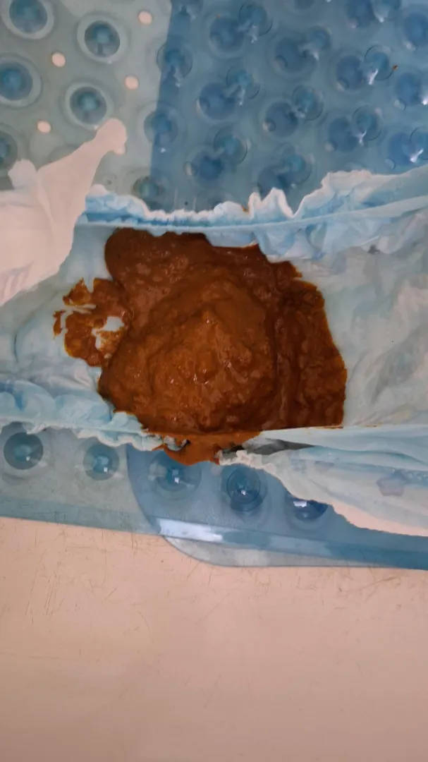Poopy mess in luvs posted by Ready-Anteater-866
