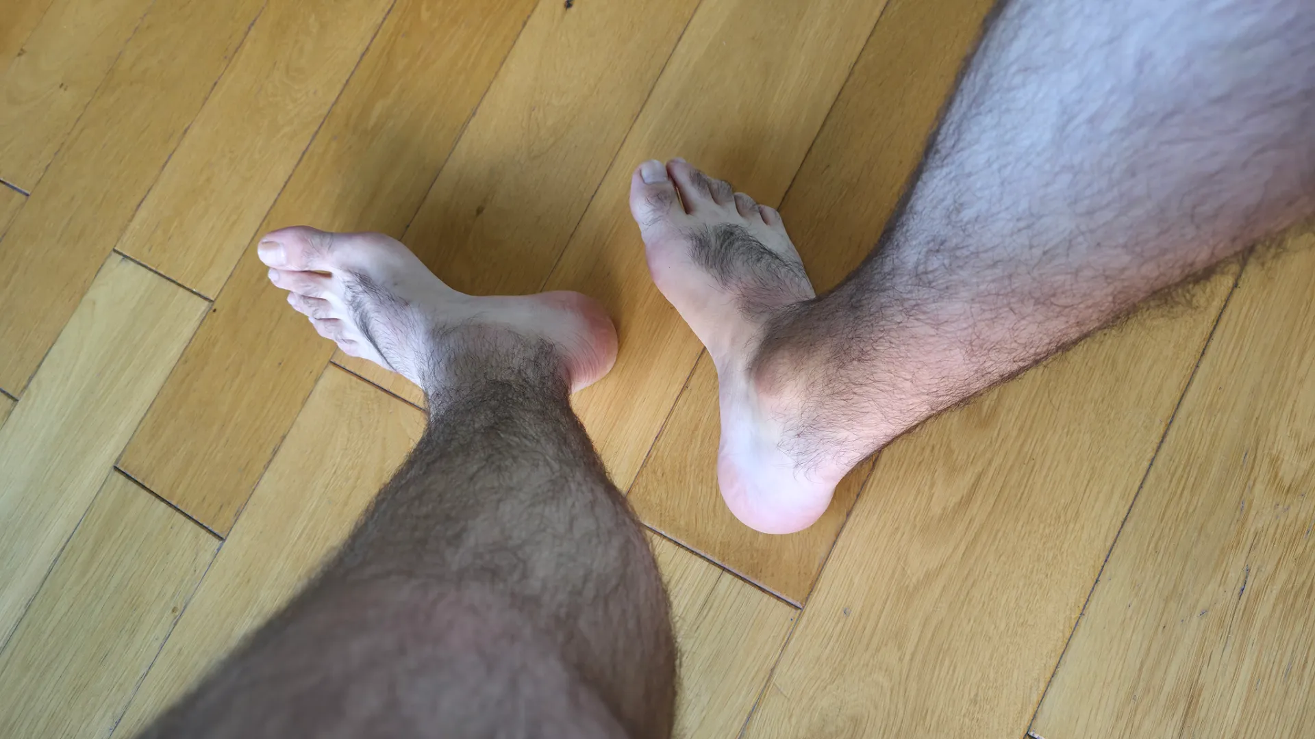 POV: You’re on the floor looking up at my hairy feet after I kicked off my shoes posted by Weak_Feed699
